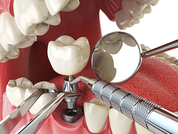 Best Emergency Dental Care for Broken or Chipped Teeth in Prague, OK